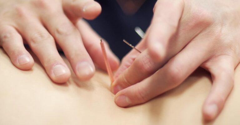 Mehr über den Artikel erfahren Wie lange wirkt Akupunktur? Alles, was Sie wissen müssen