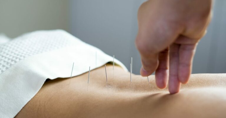 Mehr über den Artikel erfahren Kann man mit Akupunktur Abnehmen? Praxis Beindorff München